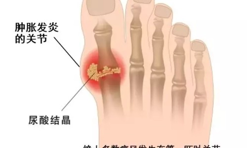 都可喜药还在生产吗-权威都可喜药物使用方法平台,分享专业都可喜片的功效作用知识_都可喜说明书网